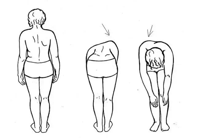 孩子脊柱弯了怎么矫正视频,孩子的脊柱怎么弯