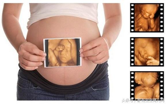 什么是过期妊娠？预产期过了多少天有危险？过期妊娠孕妈该怎么办