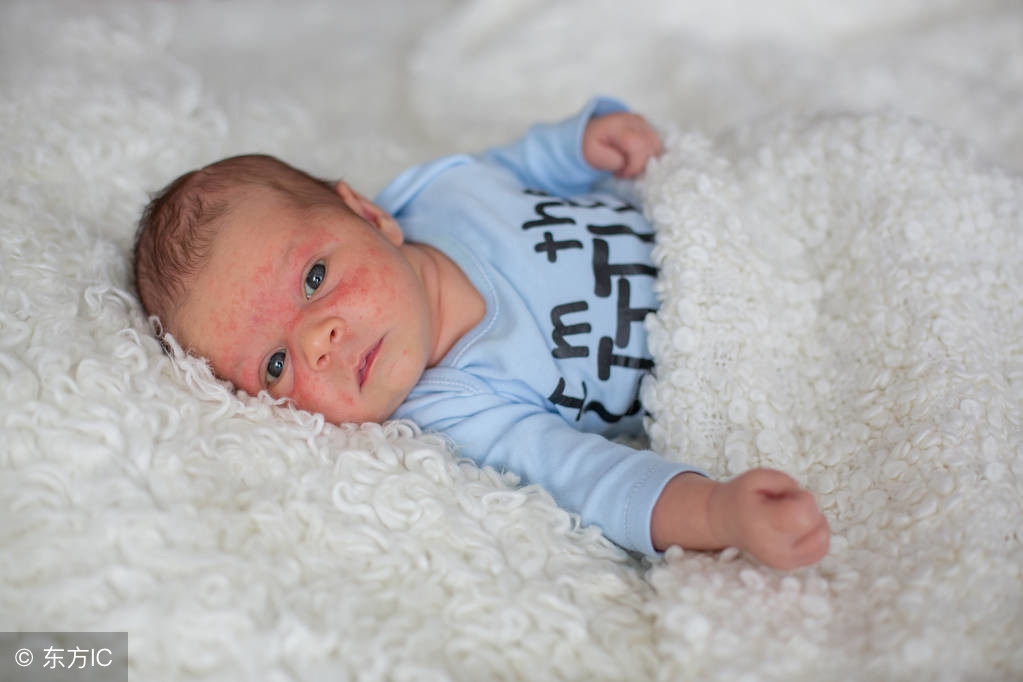 如何判断湿疹还是口水疹,红屁屁还有小红疹怎么护理好得快