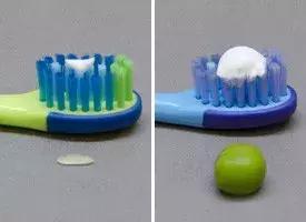 2岁宝宝牙齿坏了需要补吗,2岁宝宝牙齿烂得只剩牙根