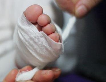 哺乳期风热感冒快速好的方法,哺乳期风热感冒的治疗方法