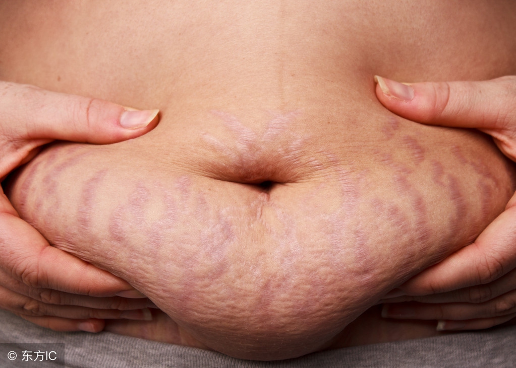 产后产妇的身体和生理变化有哪些,产后妈妈皮肤变化的表现