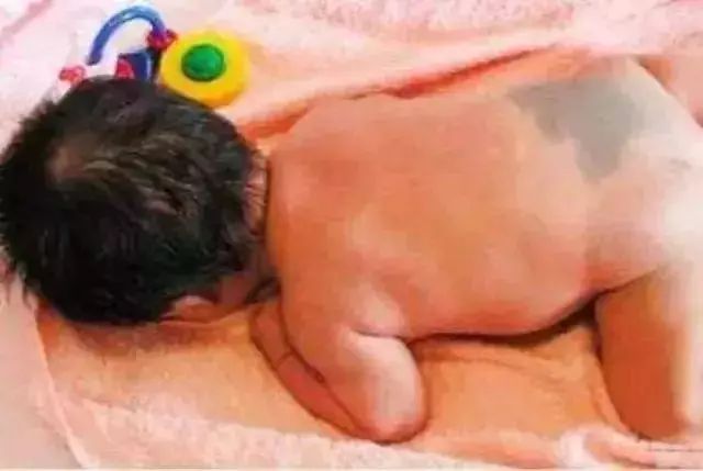 新生儿特有12个生理现象，统统都是正常的，爸妈不必太担心！