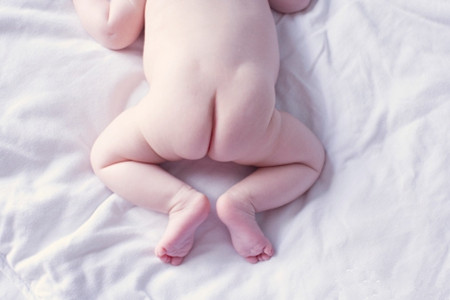 宝宝老是烂屁股是纸尿裤过敏吗,宝宝老是烂屁股是什么原因