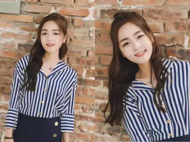 提高颜值是真的吗,发际线后移颜值下降