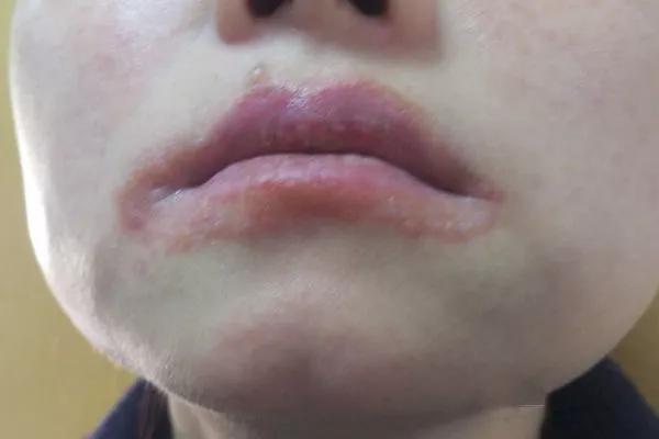 刚吃半个，男子竟差点送命！这种水果正大量上市，很多人爱吃！