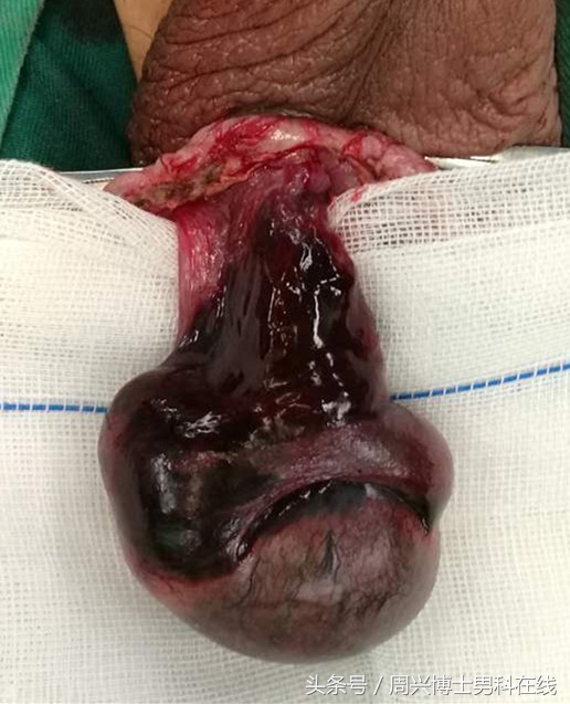 蛋蛋的忧伤原版,蛋蛋的忧伤拳击版