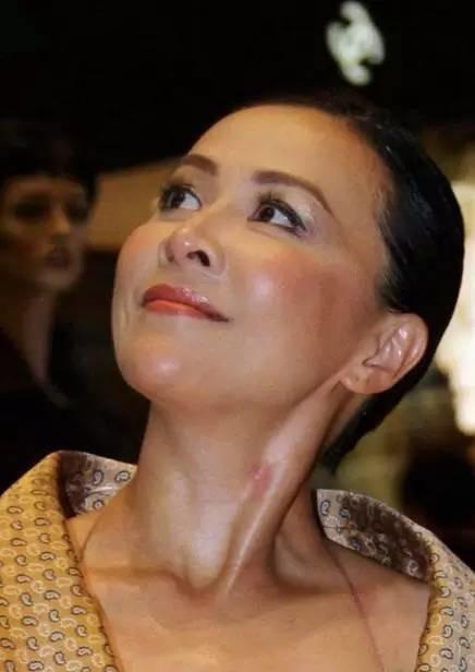 明星脖子上的“小草莓”太抢镜，赵薇甚至多次都能被拍到吻痕？