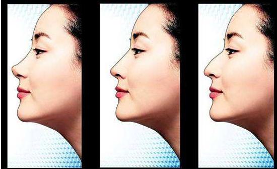 热巴缩鼻翼了吗,热巴通天鼻