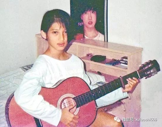 戴佩妮扁平足拇指外翻图片,戴佩妮扁平足