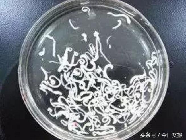 吃了活蝌蚪会怎样,喂孩子吃活蝌蚪能治病