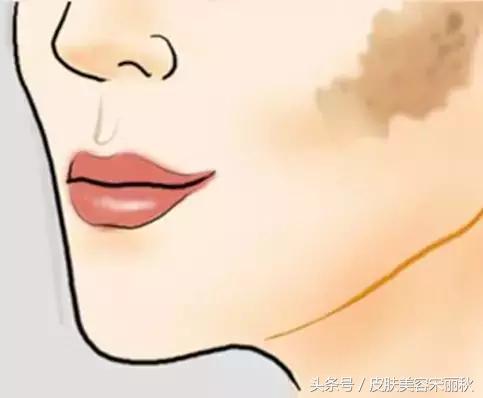 皮肤美容春夏秋冬护理方案,宋丽秋激光祛斑