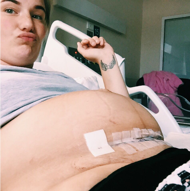 剖宫产并发症怎么治疗,剖宫产并发症是什么