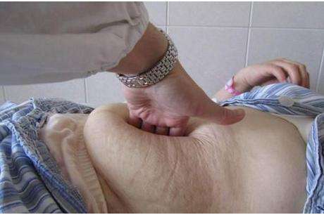 剖腹产其实也很疼，护士压产妇肚子，生孩子太不容易了