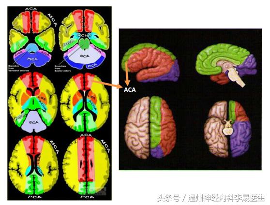 张景明教授讲脑中风后遗症,李医生讲中风视频全集