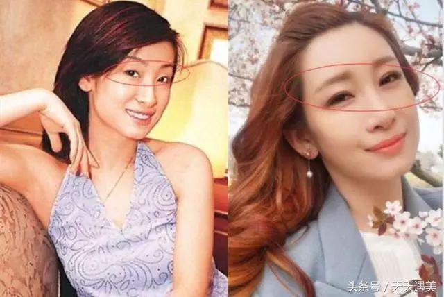 大方承认割双眼皮的明星,戚薇旗下明星