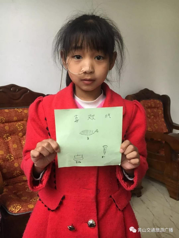 黄山11岁女孩章剑婷误食烧碱食管穿孔只能“挂牛奶”