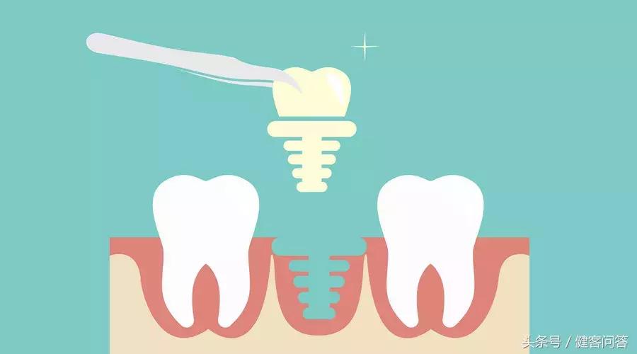 大姨妈走后还有事情要做？你知道吗
