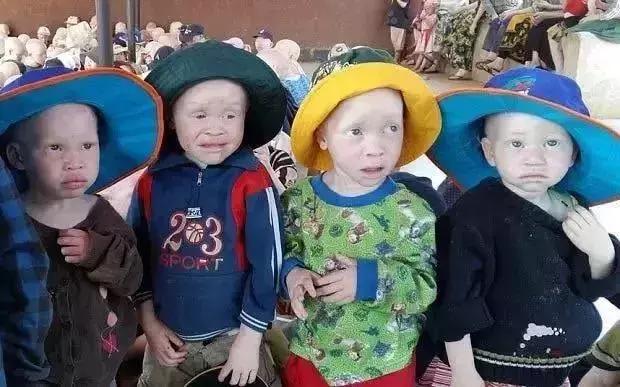 生吃它可以强身健体?这些“民间偏方”真是分分钟要人命!