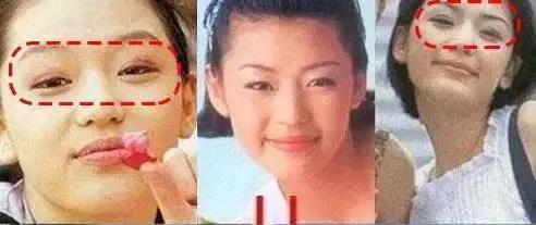 单眼皮肿眼泡无神怎么办,单眼皮肿眼泡眼妆怎么化