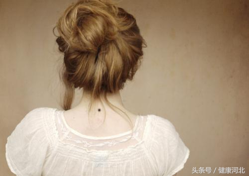 身体这3种痣别乱抠当心引发癌变,痣用手抠掉后有红褐色印记