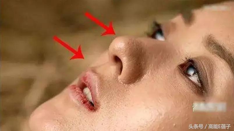 别傻了！蔡徐坤、Angelababy都根治不掉的黑头，微商神器能去除？