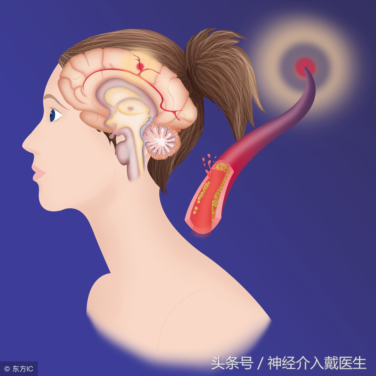 不同的他汀可以随便换着吃吗,他汀药能长期服用吗