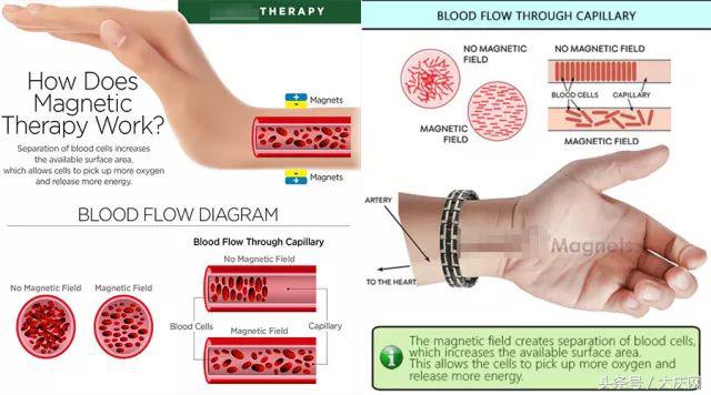碰到这5类保健品要小心,保健品的四大常见误区
