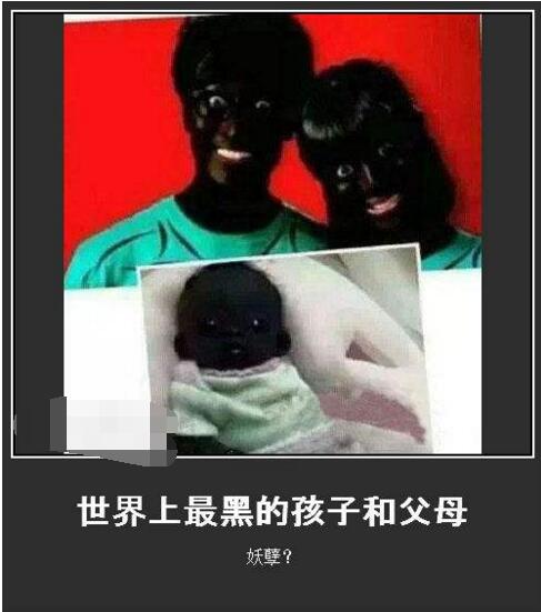 世界上最黑的小孩长大后成这样了,世界上最黑的小孩长大后