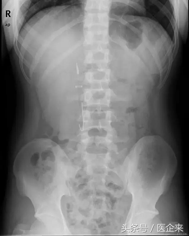 不可思议奇怪的东西,不可思议的不明物体