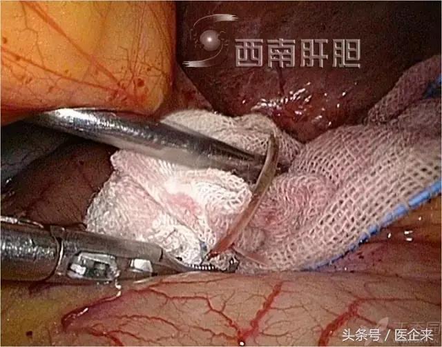 不可思议奇怪的东西,不可思议小物件穿透