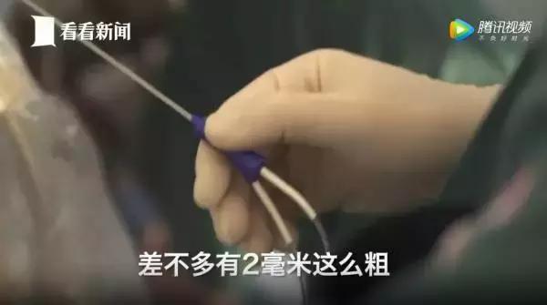 20岁女大学生捐卵,女大学生捐卵案