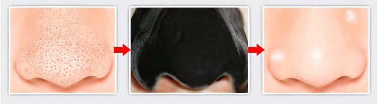 怎样才能让鼻子变小变甜,怎样才能让鼻子变小变漂亮