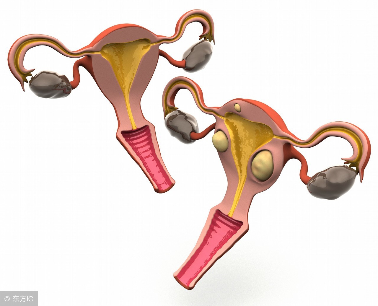 女性宫颈肥大用什么药,宫颈肥大下垂什么症状