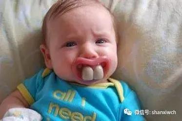 育儿知识关于牙齿,育儿知识幼儿牙齿敏感期