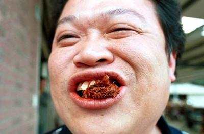 槟榔的危害口腔癌患者早期,食用槟榔导致口腔癌现状