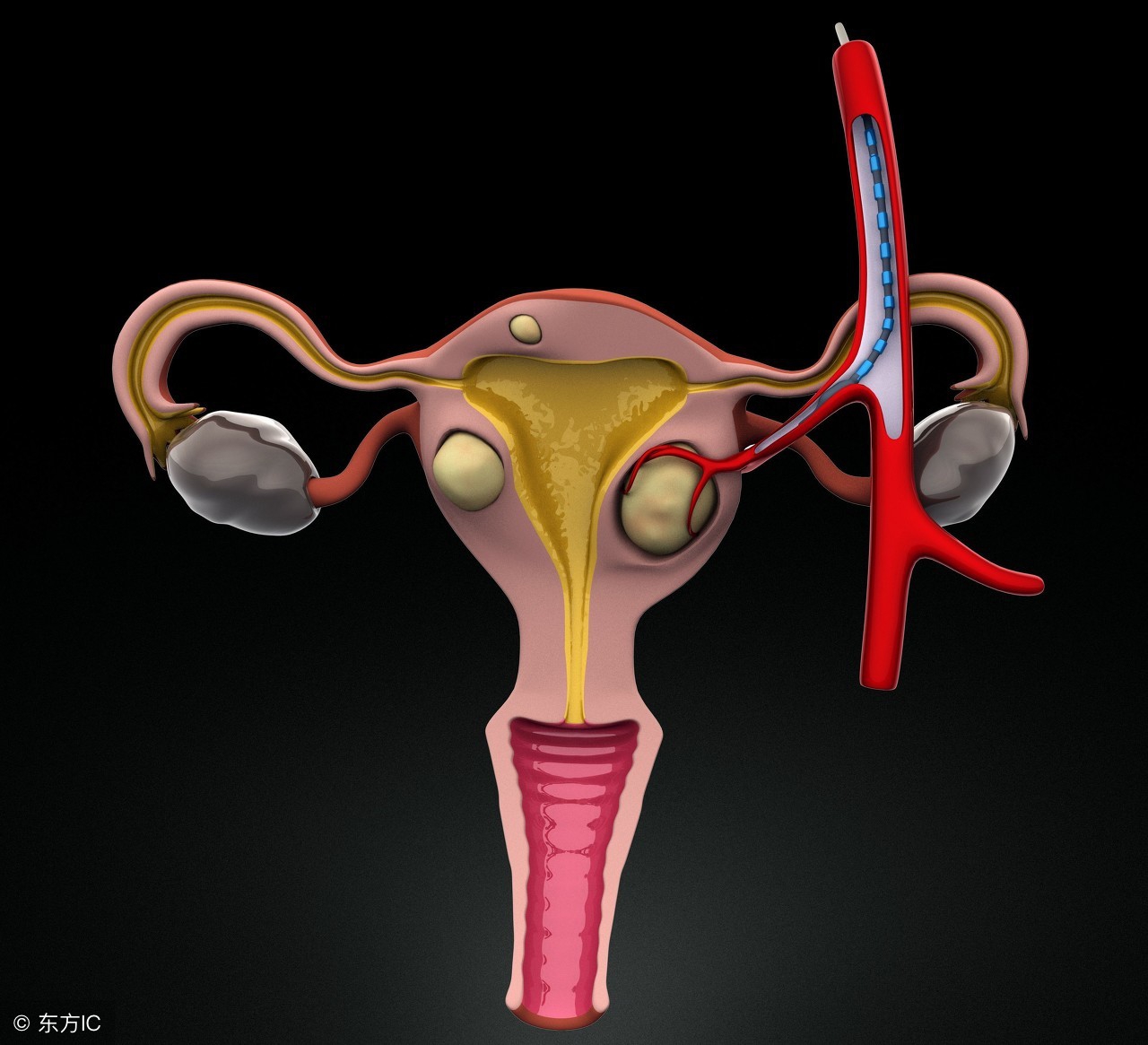 宫颈肥大的病因与病理改变