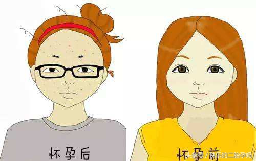 宝妈怀孕期间有这三种表现,孕妇有这些症状多半要生了