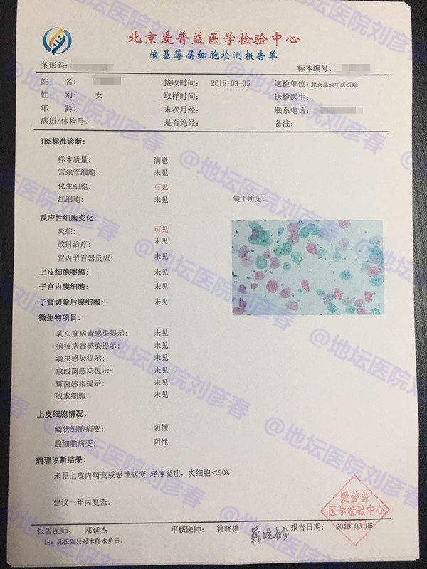 宫颈cin3累及腺体排除宫颈病变,宫颈高度病变cin3累及腺体是癌吗