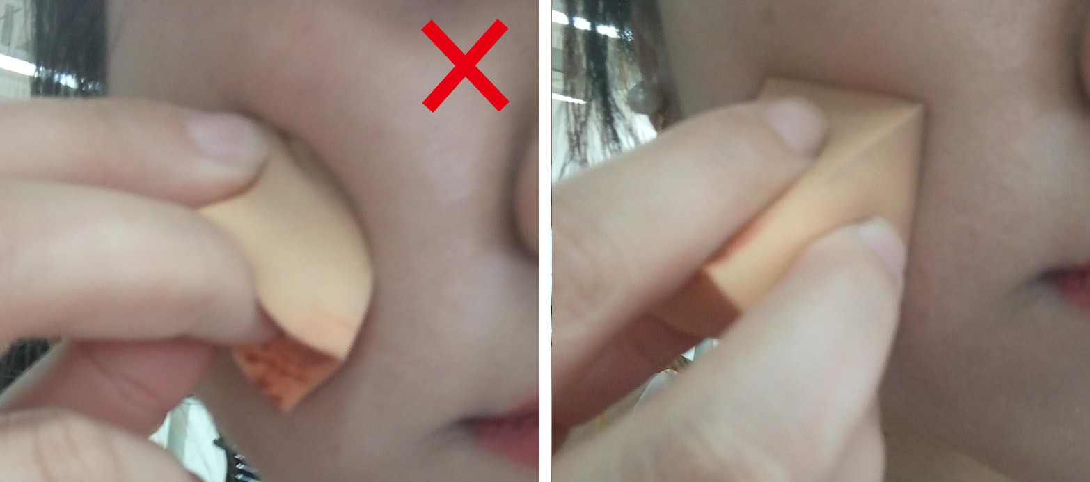 青少年痘印怎么消除小妙招,如何消除痘印祛痘