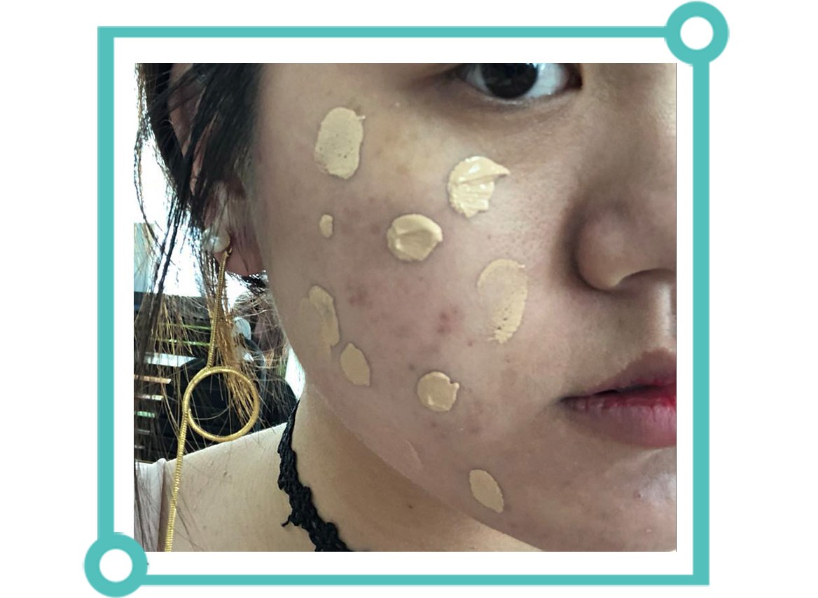 怎样消除痘印食疗,青春期痘印怎么消除小妙招