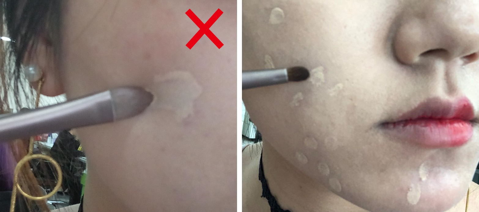 青少年痘印怎么消除小妙招,如何消除痘印祛痘