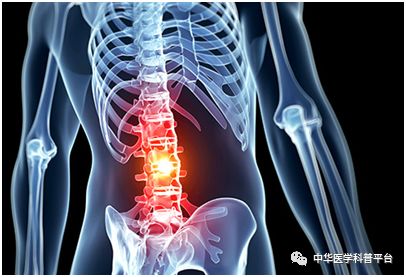 左腰背部疼痛是什么原因引起的,湿气重会腰背部疼痛吗