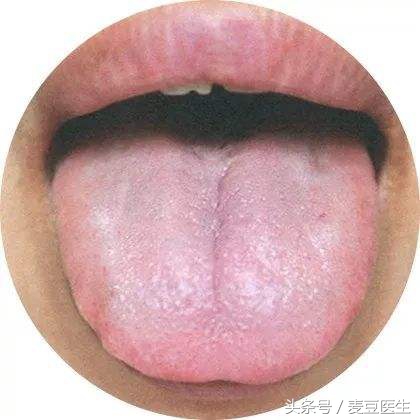 最全中医舌诊图谱来啦!看舌头,知全身!