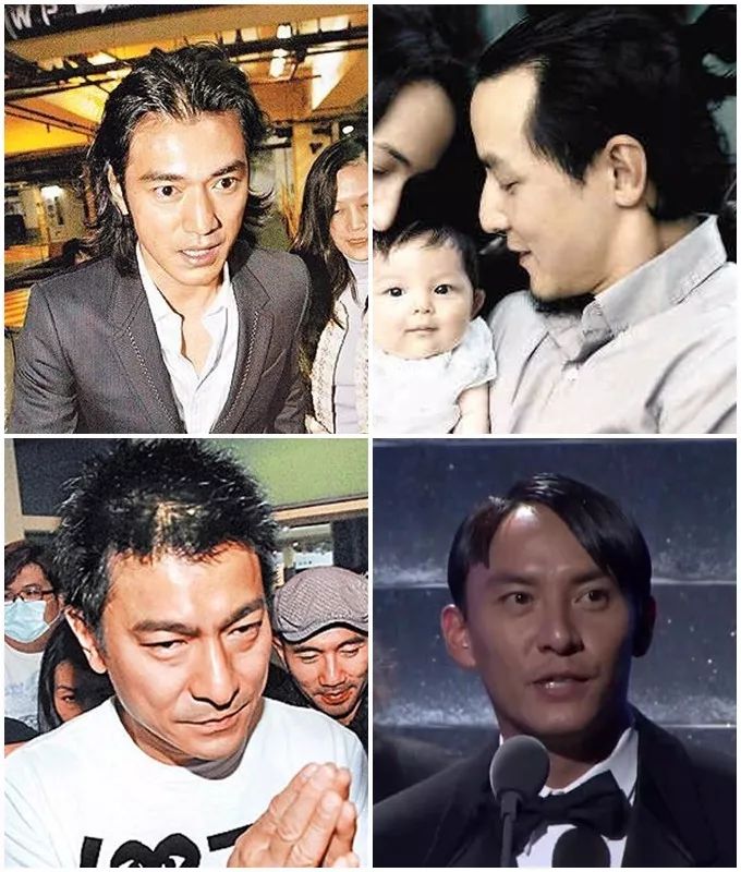 侧柏叶怎么防脱发和生发偏方大全,防脱发偏方用多久见效