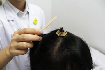 「康复吧」头晕、头痛怎么办？这个方法帮你忙