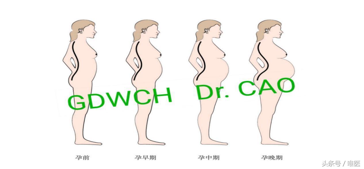 妊娠早期两个月腰痛怎么办,缓解怀孕期间腰痛的6个方法
