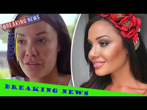 全球顶级整形手术,澳洲医美比国内好吗