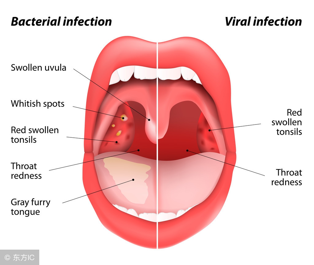 有效缓解口腔溃疡的食物,适合口腔溃疡吃的食物