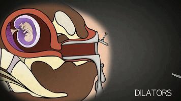 孕期吃错什么药会导致流产,孕妇吃错药对宝宝有影响吗